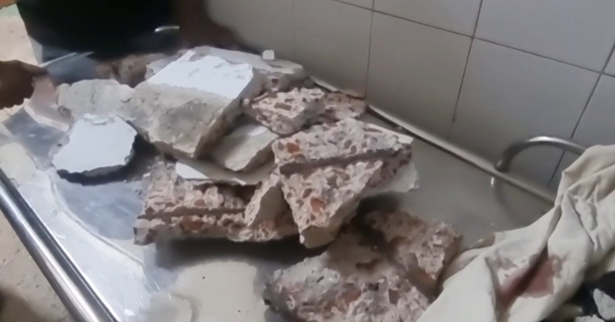 সরকারি হাসপাতালে সার্জারি ওয়ার্ডে পলেস্তারা খসে পড়ে ৩ রোগী আহত